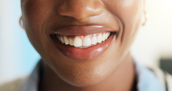 Does Dental Insurance Cover Dental Crowns?