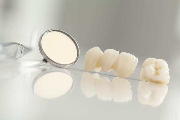 Who Should Consider Getting Dental Crowns?